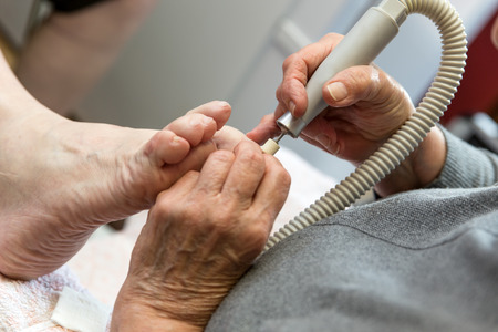 chiropodist gives a treatment of the feetの写真素材