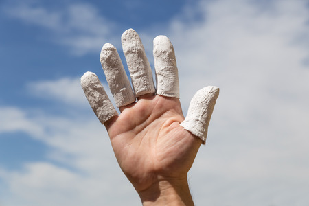 hand in front of blue sky, injured finger, concept insurance