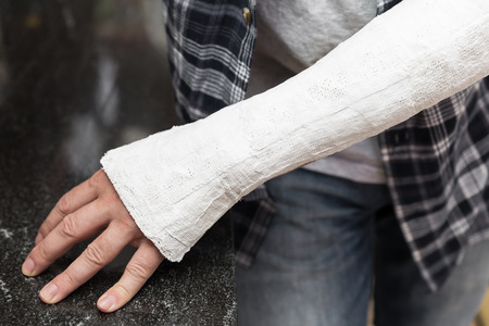 man with injured arm is leaning at a tableの写真素材