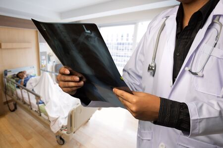 Close up of male doctor holding xray with patient in background