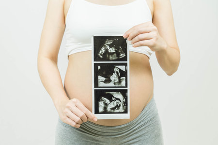 A young pregnant woman holding ultrasound images over grey background.Concept of pregnancy, health care, gynecology, medicine. Young mother waiting of the baby.の写真素材