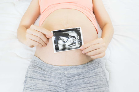 Top view of a pregnant woman lying on the bed, holding x-ray image of her baby.の写真素材