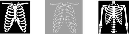 Set of x-ray of human vector on black and white background