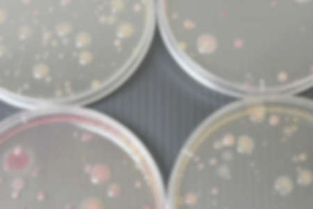 Colonies of bacteria in petri dish (culture medium plate).の写真素材