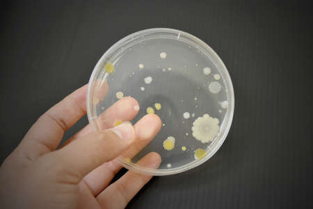 Colonies of bacteria growth on agar plate medium in microbiology laboratory.