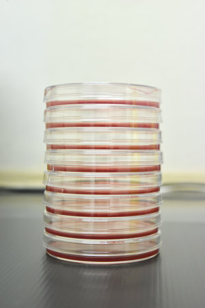 Petri dishes filled with colorful agar growth medium. Medical science equipment. Research,...