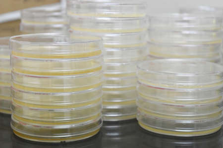 Petri dishes filled with colorful agar growth medium. Medical science equipment. Research, laboratory, science.の写真素材