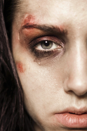 Sad beaten up girl with wounds on the face looking at the camera with deep lookの素材 [FY31027922713]