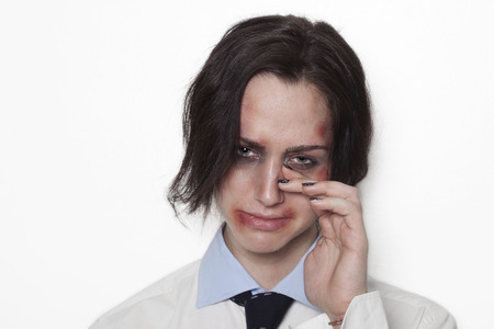Sad beaten up girl with wounds on the face looking and cryingの写真素材