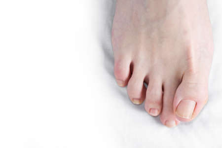 Toenails on a woman's feet