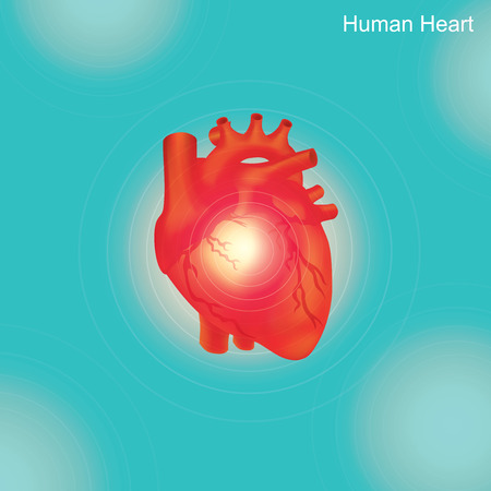 Angioplasty is an endovascular procedure to widen narrowed or obstructed arteries or veins.のイラスト素材
