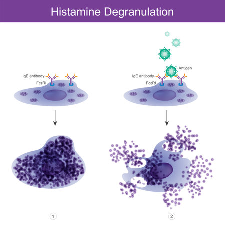 Histamine Degranulation. Histamine degranulation out of mast cell.のイラスト素材