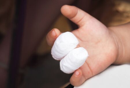 Gauze bandages on fingers. Accidental wound injury Things to watch out for small children.