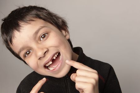 young boy showing is teeth.の写真素材