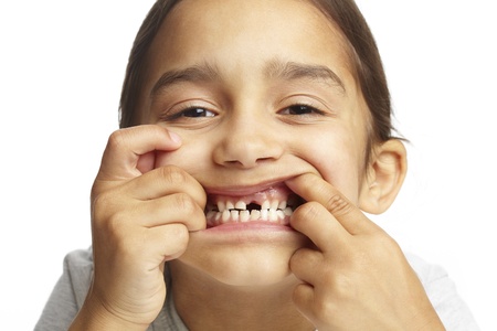 Young girl with missing front tooth on white backgroundの写真素材