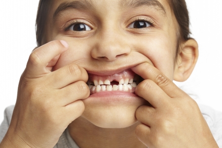 Young girl with missing front tooth on white backgroundの写真素材