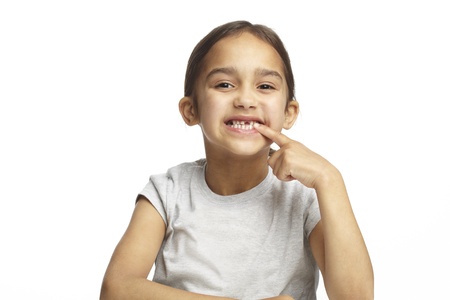 Young girl with missing front tooth on white backgroundの写真素材