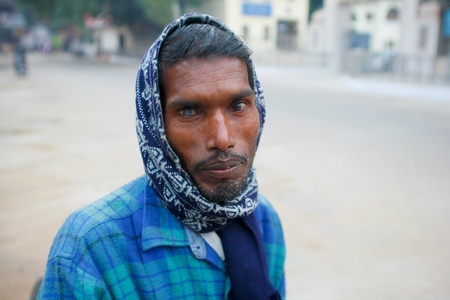 DELHI - JANUARY 18: Rickshaw driver with cataract in one eye on January 18, 2008 in Delhi, India. It's estimated that 20 million people were blind due to cataract in India.のeditorial素材