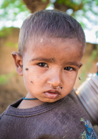 GODWAR REGION, INDIA - 15 FEBRUARY 2015: Young Indian child with flies around face.のeditorial素材