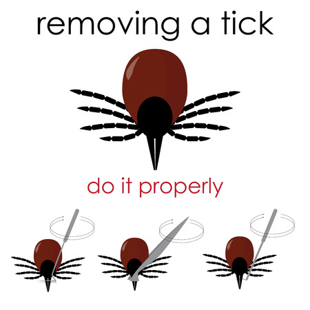 infographic vector illustration on how to properly remove a tick, and avoid lyme disease.のイラスト素材