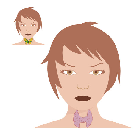 illustration of thyroid disease with Hashimotosのイラスト素材