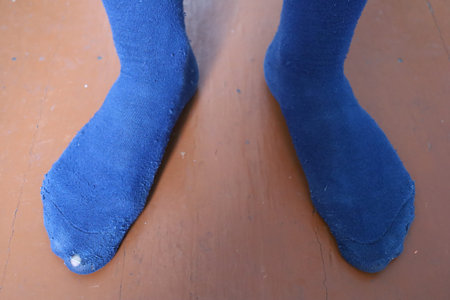 The poor man in torn socksの写真素材