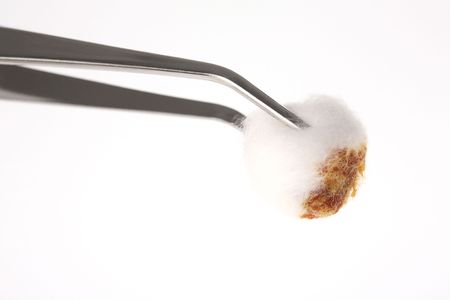 Gauze and tweezersの写真素材