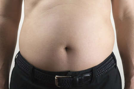 Obeseの写真素材