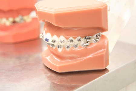 Orthodontic appliances