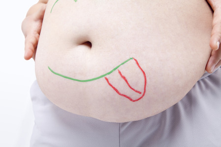 Belly metabolic syndrome womenの写真素材