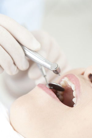 Women who undergo dental treatmentの写真素材