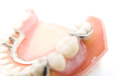 Model of Partial Denturesの写真素材