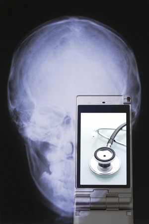 Stethoscope reflection in X-ray photography and mobile screenの写真素材
