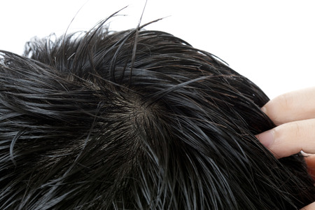 Scalp