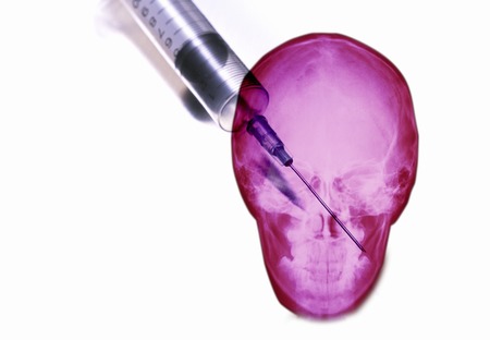 X-ray and syringeの写真素材