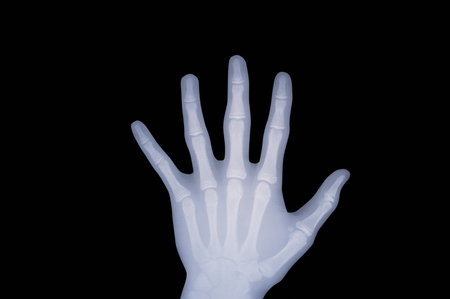 The hands of the radiographの写真素材