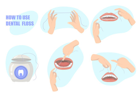 Colorful instruction for dental floss flat illustration set. Cartoon images for medical cleaning of teeth isolated vector illustration collection. Oral health, hygiene and care conceptのイラスト素材
