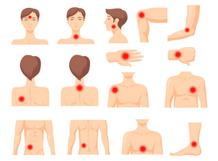 Focus of pain set. Parts of human body with red spot, ache in muscles or joints. Vector illustration for inflammation, chronic disease, painkiller, health problem conceptのイラスト素材