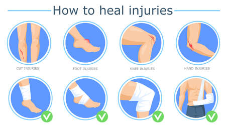 Healing of different injuries poster. Cartoon vector illustration. Methods of bandaging foot, knee, hand wounds with elastic roller. Treating, healing, bleeding, first aid concept for banner designのイラスト素材