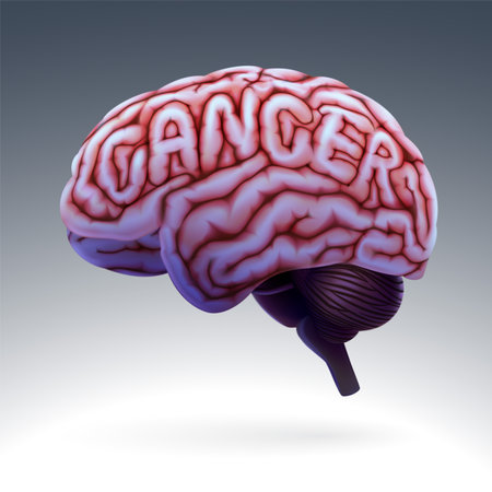 3D human brain illustration curled into word cancer. Used in medicine, education and industry.のイラスト素材