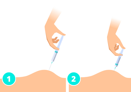 A doctor makes an intramuscular injection. Hand with syringe injects the medicine into the patient's muscle. Science, treatment, therapy, vaccination and health care vector flat concept illustration.のイラスト素材