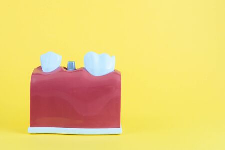 False mouth on yellow background with toothbrush