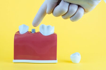 False mouth on yellow background with toothbrush