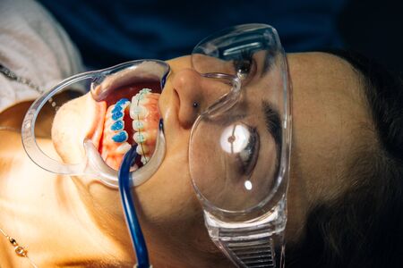 process of placing white dental braces to a Caucasian girl in a dental clinic with a dentist girl....