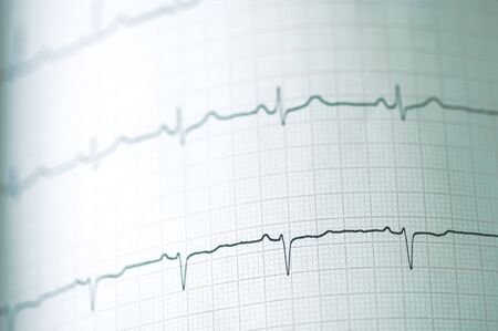 Detail of an electrocardiogram in paper