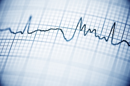 Close up of an electrocardiogram in paper form.