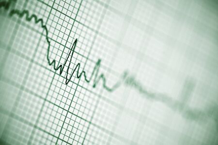 Close up of an electrocardiogram in paper form.
