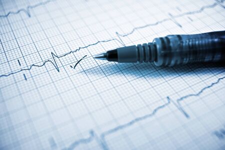 Close up of an electrocardiogram in paper form.の写真素材