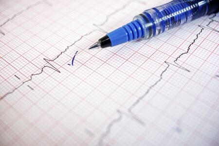 Close up of an electrocardiogram in paper form.
