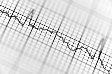 Close up of an electrocardiogram in paper form.